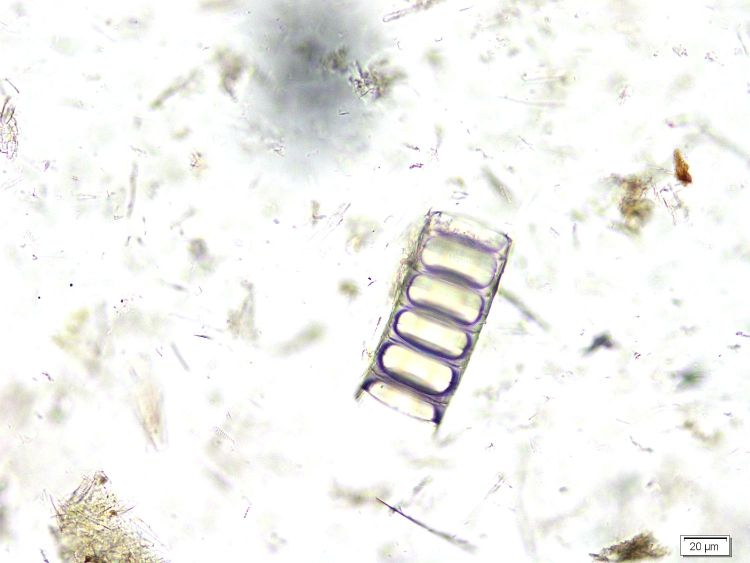  Microscope Diatomite Diatomite finement stratifiée de Saint Bauzile Massif central Monts du Vivarais Saint Bauzile Montagne d’Andance